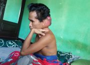 Pria Pengidap Tumor Ganas dari Lombok Tengah Butuh Uluran Tangan