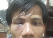 Mantan Sekretaris Cabang PMII Mataram Dipukul Orang Tidak Dikenal