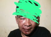 Setelah 6 Bulan, Polresta Mataram Buru Terduga Pelaku Penganiayaan di Sunset Land