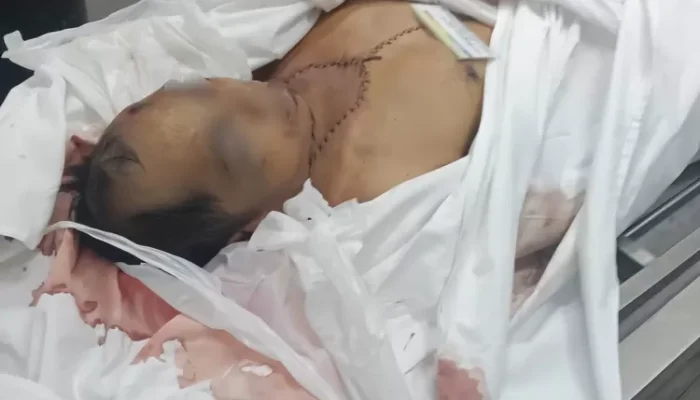 Jenazah PMI Asal Masbagik Penuh Jahitan Pulang dari Malaysia, Keluarga Curiga Organ Dicuri