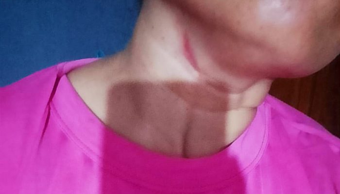 ‎Ormas Ganas Advokasi Hijriati, Korban Kekerasan Mahidin di Kembang Are Sakra Barat